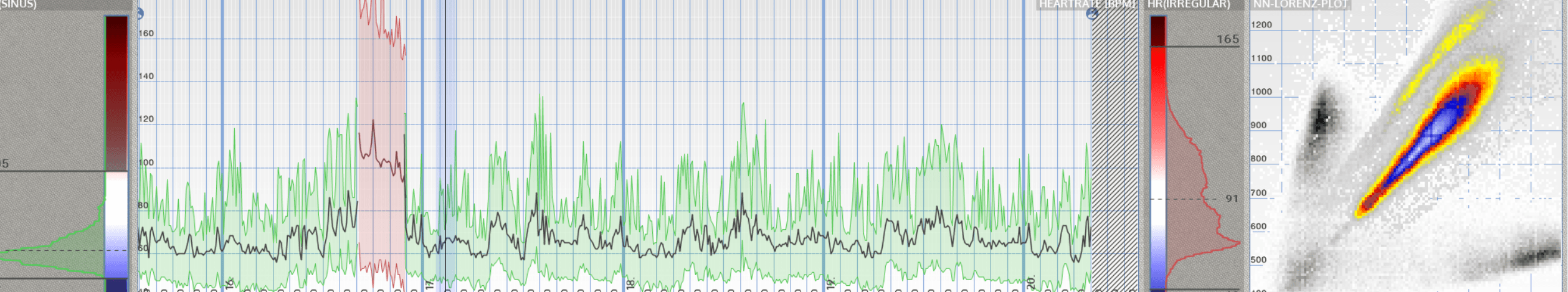 curba puls si HRV fia