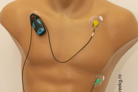 Monitorizare simplă