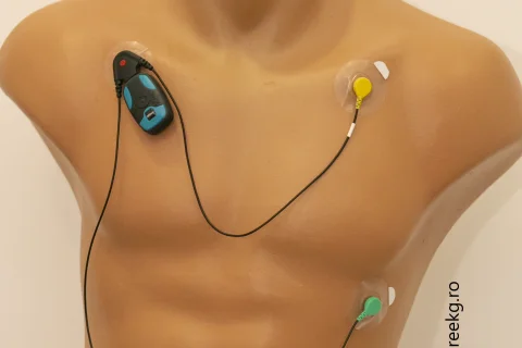 Monitorizare simplă