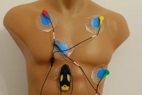 Monitorizare standard